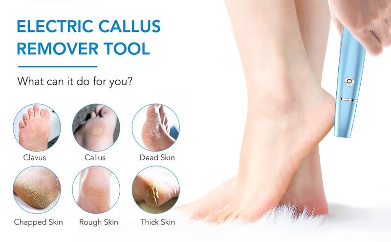 Hot Sale - 50% OFF🔥Electric Feet Callus Remover⚡