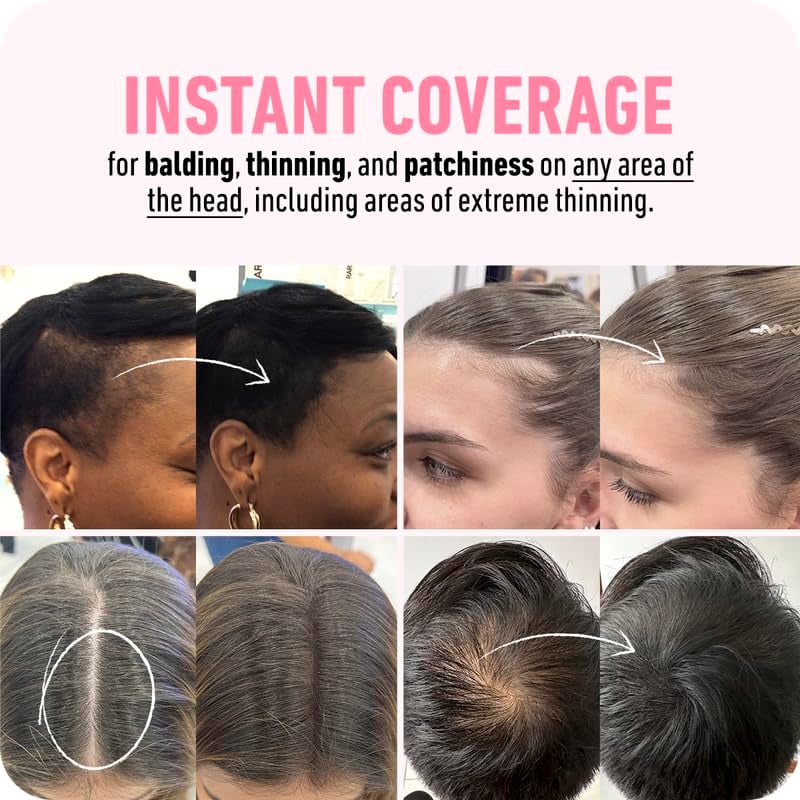 đLast Day 70% OFFđBuy 2 Get 1 FreeđRoot Cover Up For Effortless Beauty