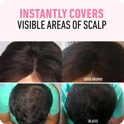 đLast Day 70% OFFđBuy 2 Get 1 FreeđRoot Cover Up For Effortless Beauty