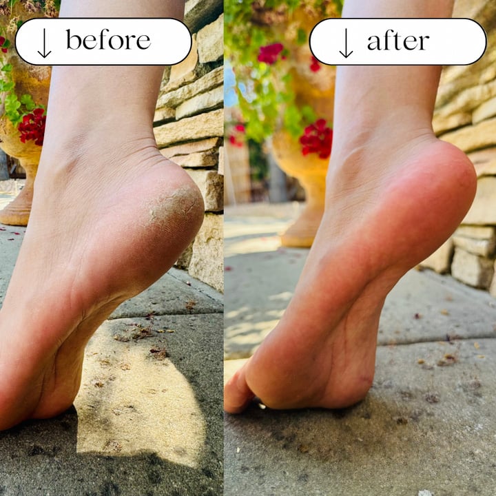 💥LAST DAY SALE 50% OFF - Foot File