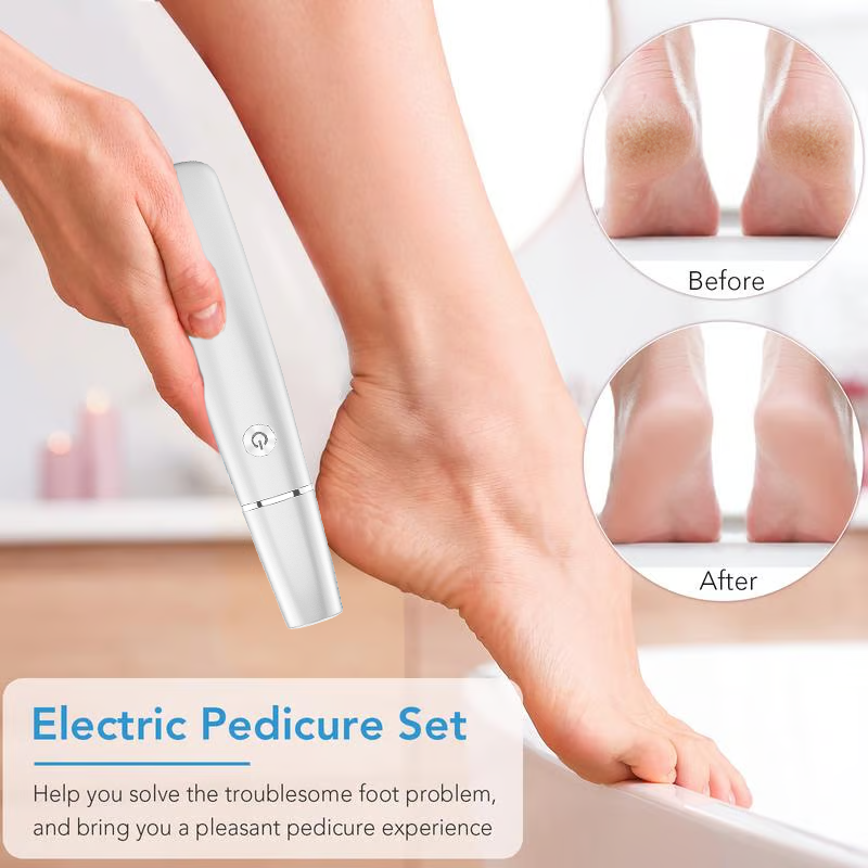 🔥Last Day Special Price £10.99!!💥-🎁Portable Electric Feet Callus Remover