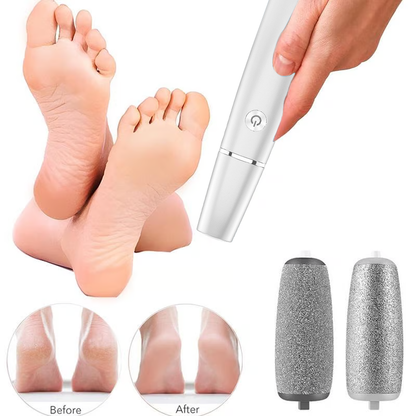 🔥Last Day Special Price £10.99!!💥-🎁Portable Electric Feet Callus Remover