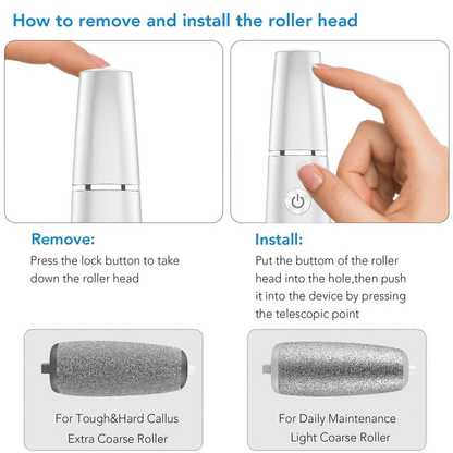 🔥Last Day Special Price £10.99!!💥-🎁Portable Electric Feet Callus Remover