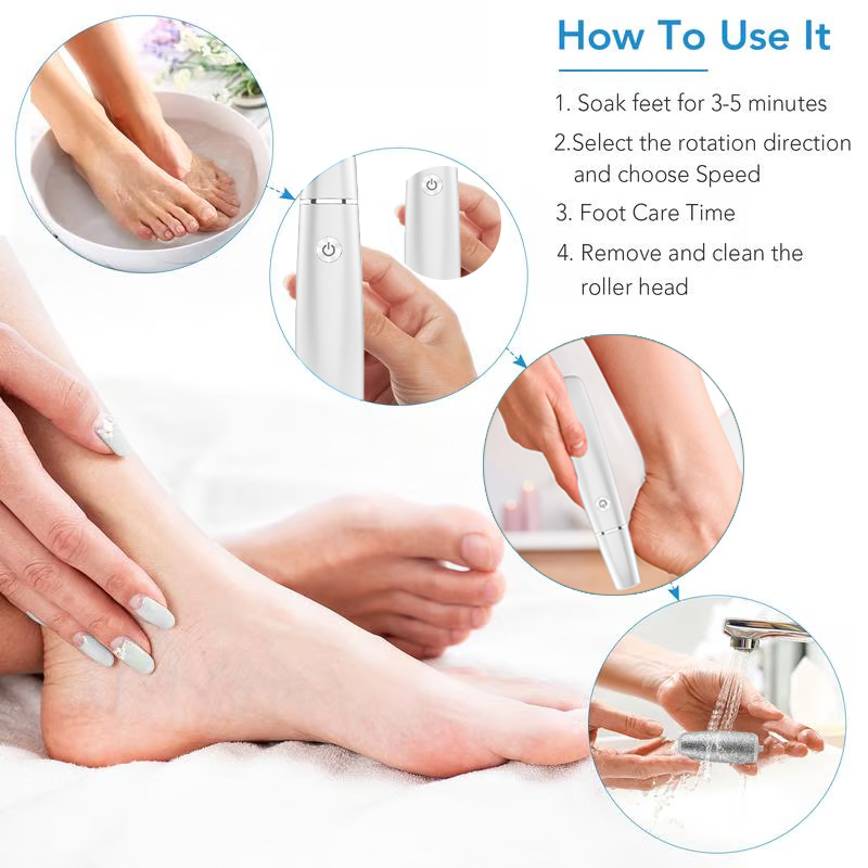🔥Last Day Special Price £10.99!!💥-🎁Portable Electric Feet Callus Remover