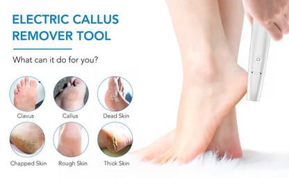 🔥Last Day Special Price £10.99!!💥-🎁Portable Electric Feet Callus Remover
