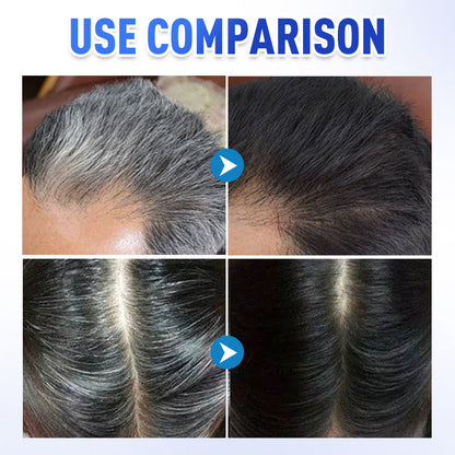 📢Hot Sale 49% OFF🔥Gentle Instant Gray Hair Cover Dye