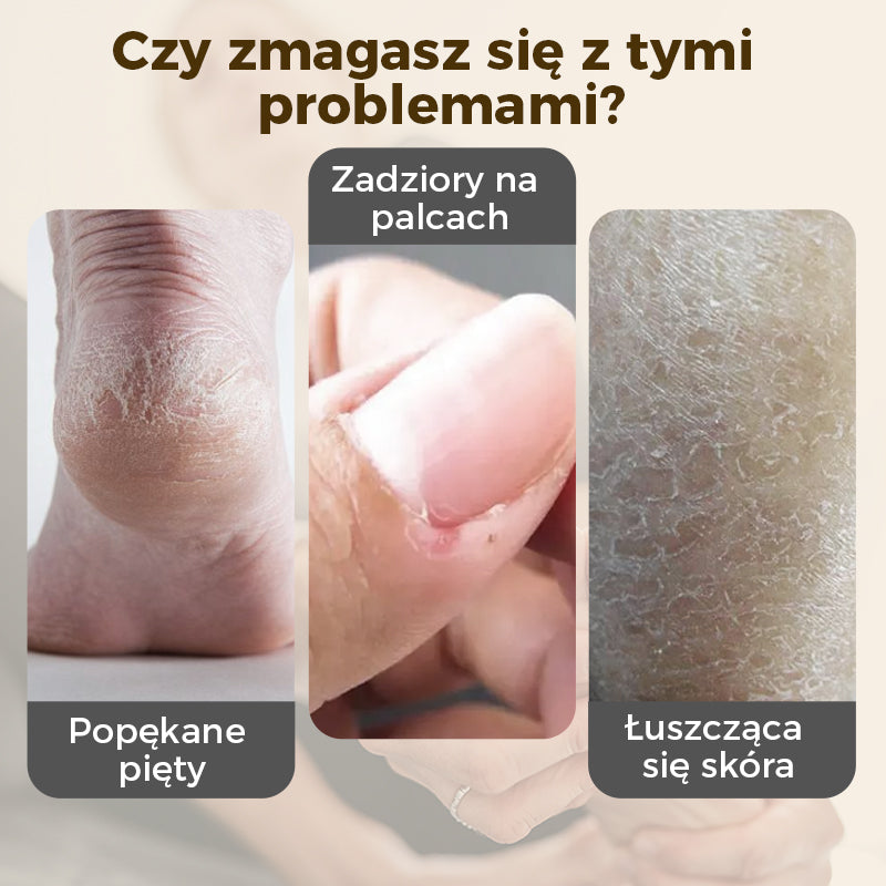 Intensywny balsam naprawczy do pękających pięt i suchych dłoni