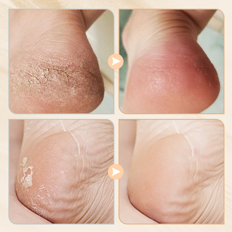 Intensywny balsam naprawczy do pękających pięt i suchych dłoni