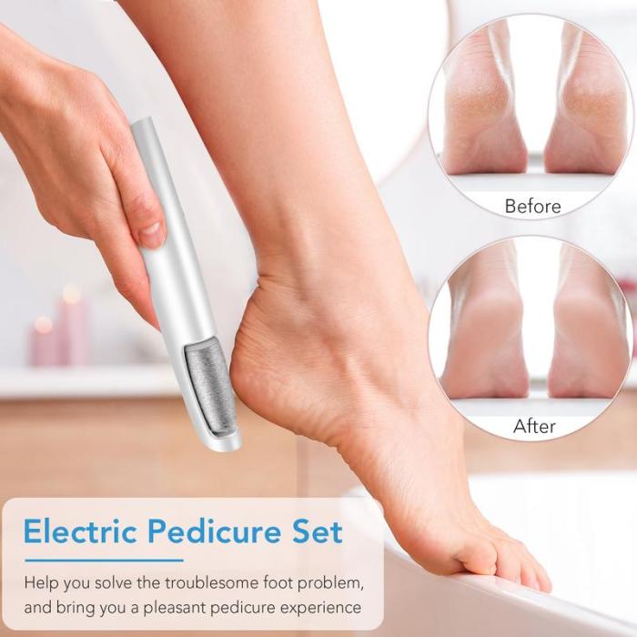 🔥Last Day Special Price £10.99!!💥-🎁Portable Electric Feet Callus Remover